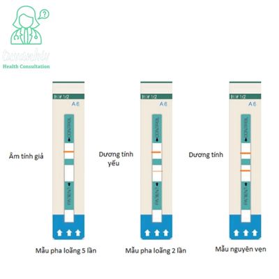 Cách đọc kết quả xét nghiệm test HIV tại nhà