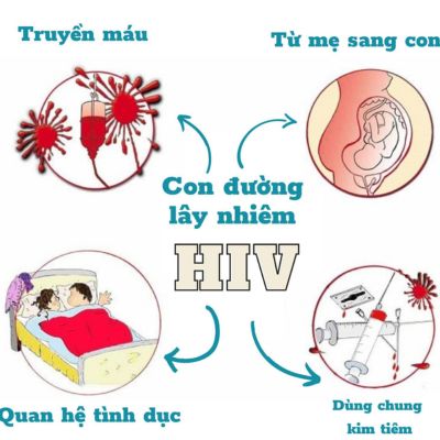 HIV lây nhiễm qua 4 con đường chính