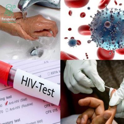 Cách xử lý khi bị phơi nhiễm HIV