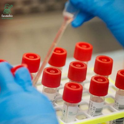 Thời điểm thích hợp để Test nhanh HIV AB