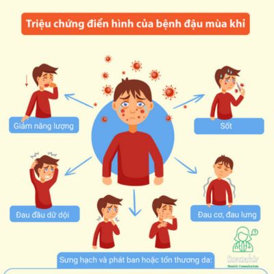 Triệu chứng điển hình của bệnh đậu mùa khỉ