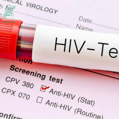 Thời gian xét nghiệm HIV 