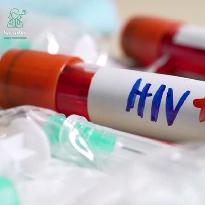 Những điều kiện có thể làm giảm khả năng sống sót của virus HIV trong giọt máu khô