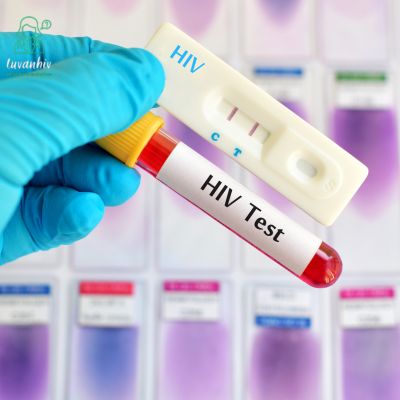 Xét nghiệm HIV