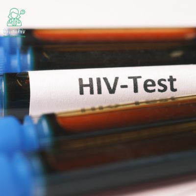 Xét nghiệm chẩn đoán nhiễm HIV