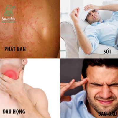 Dấu hiệu nhiễm HIV ở nam