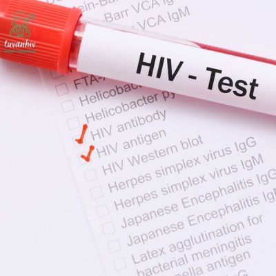 Xét Nghiệm HIV